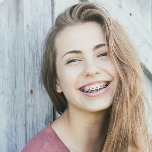 Retainers
