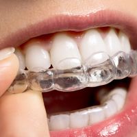 Invisalign
